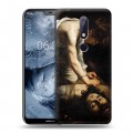 Дизайнерский пластиковый чехол для Nokia 6.1 Plus