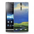 Дизайнерский пластиковый чехол для Sony Xperia S