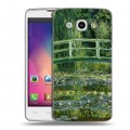 Дизайнерский пластиковый чехол для LG L60