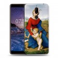 Дизайнерский пластиковый чехол для Nokia 7 Plus