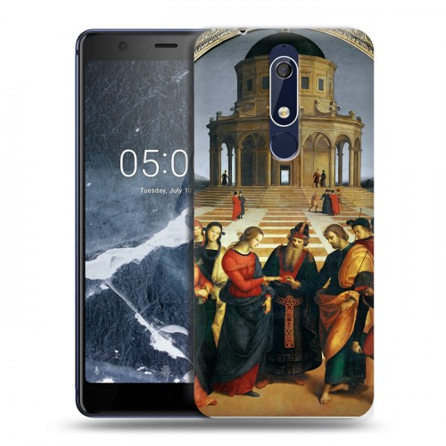 Дизайнерский пластиковый чехол для Nokia 5.1