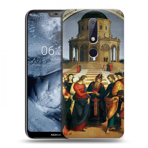 Дизайнерский пластиковый чехол для Nokia 6.1 Plus