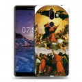 Дизайнерский пластиковый чехол для Nokia 7 Plus