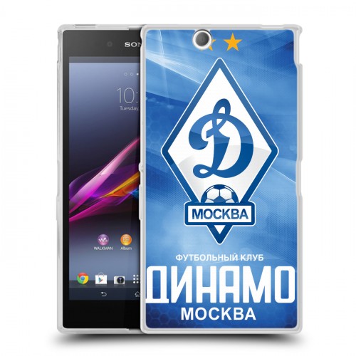 Дизайнерский пластиковый чехол для Sony Xperia Z Ultra  Динамо