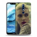 Дизайнерский силиконовый чехол для Nokia 5.1 Plus Скарлет Йохансон